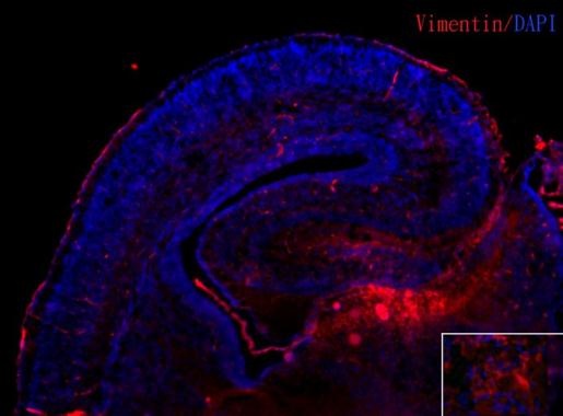 Whole cell extract (30 ug) was separated by 10% SDS-PAGE,and the membrane was blotted with Vimentin antibody [GT7812] (GTX629743) diluted at 1:1000. The HRP-conjugated anti-mouse IgG antibody (GTX213111-01) was used to detect the primary antibody.