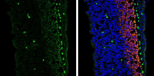 Vimentin antibody [GT812] detects Vimentin protein expression by immunohistochemical analysis.
