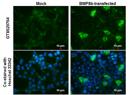 BMP8b antibody [GT1017] detects BMP8b protein at cytoplasm by immunofluorescent analysis. Sample: Mock and transfected 293T cells were fixed in 4% paraformaldehyde at RT for 15 min. Green: BMP8b stained by BMP8b antibody [GT1017] (GTX629764) diluted at 1:1000. Blue: Hoechst 33342 staining. Scale bar= 10 μm.