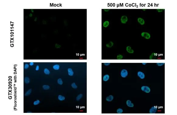 Anti-HIF1 alpha antibody [GT122] (GTX629766) | GeneTex