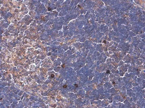 ARHGEF18 antibody [GT1972] detects ARHGEF18 protein at cytoplasm by immunohistochemical analysis. Sample: Paraffin-embedded mouse thymus gland. ARHGEF18 stained by ARHGEF18 antibody [GT1972] (GTX629806) diluted at 1:200.
 Antigen Retrieval: Citrate buffer, pH 6.0, 15 min