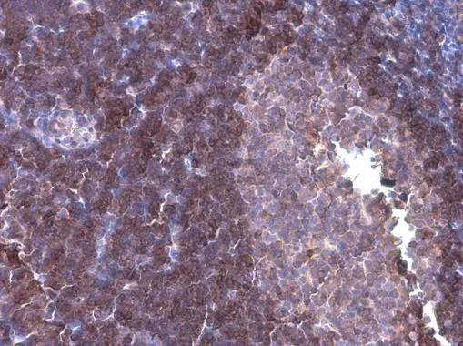 ARHGEF18 antibody [GT1972] detects ARHGEF18 protein at cytoplasm by immunohistochemical analysis. Sample: Paraffin-embedded rat lymph node. ARHGEF18 stained by ARHGEF18 antibody [GT1972] (GTX629806) diluted at 1:200.
 Antigen Retrieval: Citrate buffer, pH 6.0, 15 min