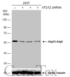 Non-transfected (–) and transfected (+) 293T whole cell extracts (30 μg) were separated by 10% SDS-PAGE, and the membrane was blotted with ATG12 antibody [GT166] (GTX629815) diluted at 1:500. The HRP-conjugated anti-mouse IgG antibody (GTX213111-01) was used to detect the primary antibody.