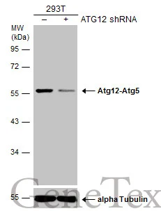 Non-transfected (–) and transfected (+) 293T whole cell extracts (30 μg) were separated by 10% SDS-PAGE, and the membrane was blotted with ATG12 antibody [GT948] (GTX629816) diluted at 1:500. The HRP-conjugated anti-mouse IgG antibody (GTX213111-01) was used to detect the primary antibody.