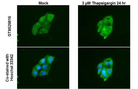 ATG12 antibody [GT948] detects ATG12 protein at autophagosome? by immunofluorescent analysis. Sample: Mock and treated HepG2 cells were fixed in ice-cold MeOH for 5 min. Green: ATG12 stained by ATG12 antibody [GT948] (GTX629816) diluted at 1:500. Blue: Hoechst 33342 staining.