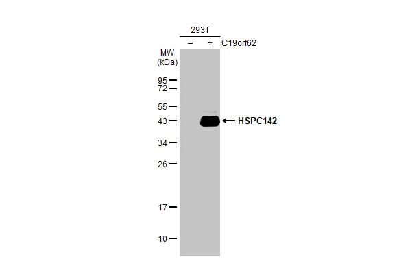 Non-transfected (–) and transfected (+) 293T whole cell extracts (30 μg) were separated by 12% SDS-PAGE, and the membrane was blotted with HSPC142 antibody [GT2810] (GTX629878) diluted at 1:5000. The HRP-conjugated anti-mouse IgG antibody (GTX213111-01) was used to detect the primary antibody.