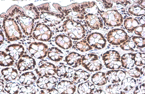 PUF60 antibody [GT917] detects PUF60 protein at nucleus by immunohistochemical analysis. Sample: Paraffin-embedded rat colon. PUF60 stained by PUF60 antibody [GT917] (GTX629887) diluted at 1:200. Antigen Retrieval: Citrate buffer, pH 6.0, 15 min