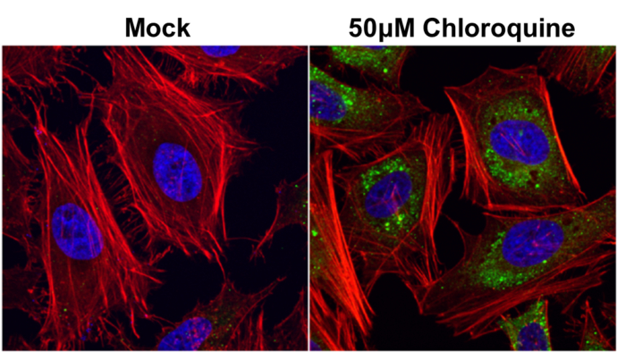 SQSTM1 antibody detects SQSTM1 protein by western blot analysis.