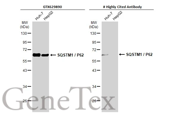 The unfolded protein response modulators GSK2606414 and