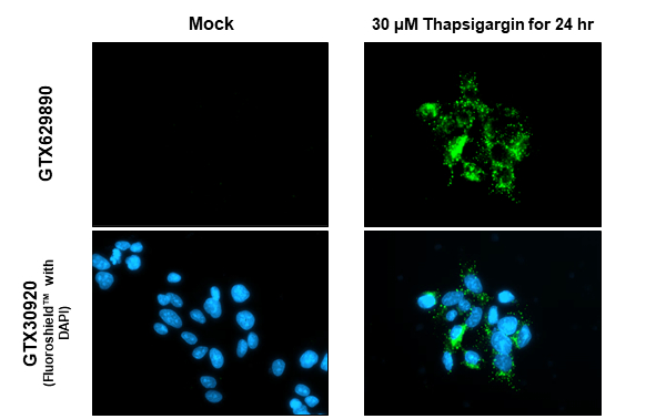 Anti-SQSTM1 / P62 antibody [GT1478] (GTX629890) | GeneTex