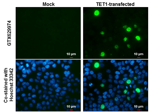 TET1 antibody [GT465] detects TET1 protein at nucleus by immunofluorescent analysis. Sample: Mock and transfected 293T cells were fixed in 4% paraformaldehyde at RT for 15 min. Green: TET1 stained by TET1 antibody [GT465] (GTX629974) diluted at 1:1000. Blue: Hoechst 33342 staining. Scale bar= 10 μm.
