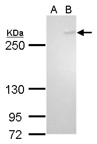 NT2D1 whole cell and nuclear extracts (30 ug) were separated by 5% SDS-PAGE,and the membrane was blotted with TET1 antibody [GT465] (GTX629974) diluted at 1:500.