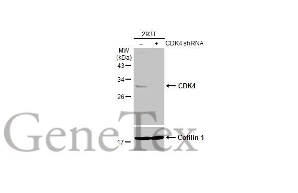 CDK4 antibody [GT624]