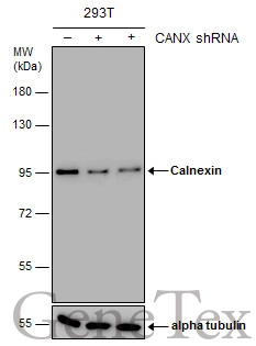 Non-transfected (–) and transfected (+) 293T whole cell extracts (15 μg) were separated by 7.5% SDS-PAGE, and the membrane was blotted with Calnexin antibody [GT1563] (GTX629976) diluted at 1:6000.