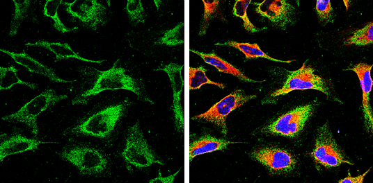 Calnexin antibody [GT1563] detects Calnexin protein by immunofluorescent analysis. Sample: HeLa cells were fixed in ice-cold MeOH for 5 min. Green: Calnexin stained by Calnexin antibody [GT1563] (GTX629976) diluted at 1:500. Red: Calnexin, stained by Calnexin antibody [C3], C-term (GTX109669) diluted at 1:500. Blue: Hoechst 33342 staining.