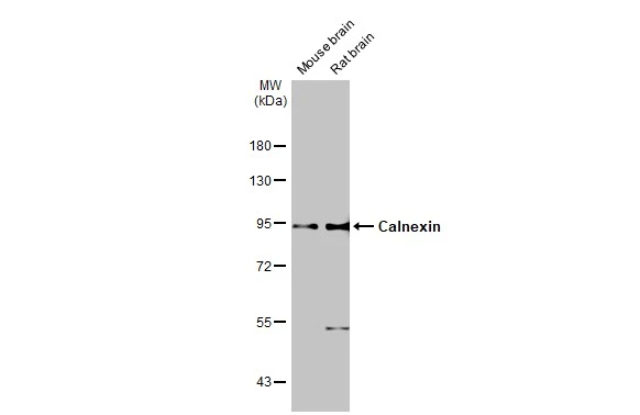 Various tissue extracts (50 μg) were separated by 7.5% SDS-PAGE, and the membrane was blotted with Calnexin antibody [GT1563] (GTX629976) diluted at 1:1000. The HRP-conjugated anti-mouse IgG antibody (GTX213111-01) was used to detect the primary antibody.