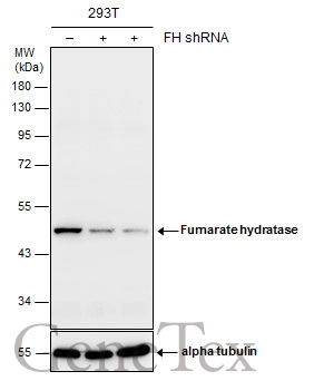 Non-transfected (–) and transfected (+) 293T whole cell extracts (30 μg) were separated by 10% SDS-PAGE, and the membrane was blotted with Fumarate hydratase antibody [GT548] (GTX630145) diluted at 1:500.
