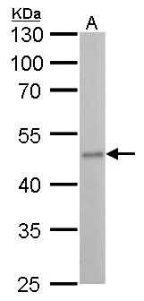 Fumarate hydratase antibody [GT548] detects Fumarate hydratase protein by Western blot analysis. A. 50 μg rat liver lysate/extract 10 % SDS-PAGE Fumarate hydratase antibody [GT548] (GTX630145) dilution: 1:500