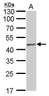 Fumarate hydratase antibody [GT7612] detects Fumarate hydratase protein by Western blot analysis. A. 50 μg mouse liver lysate/extract 10 % SDS-PAGE Fumarate hydratase antibody [GT7612] (GTX630146) dilution: 1:1000