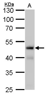 Fumarate hydratase antibody [GT7612] detects Fumarate hydratase protein by Western blot analysis. A. 50 μg rat liver lysate/extract 10 % SDS-PAGE Fumarate hydratase antibody [GT7612] (GTX630146) dilution: 1:1000