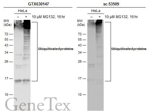 Untreated (–) and treated (+) HeLa whole cell extracts (30 μg) were separated by 12% SDS-PAGE, and the membranes were blotted with Ubiquitin antibody [GT751] (GTX630147) diluted at 1:500 and competitor's antibody (sc-53509) diluted at 1:500. The HRP-conjugated anti-mouse IgG antibody (GTX213111-01) was used to detect the primary antibody. *The competitor is not affiliated with GeneTex and does not endorse this product.