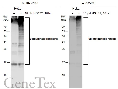 Untreated (–) and treated (+) HeLa whole cell extracts (30 μg) were separated by 12% SDS-PAGE, and the membranes were blotted with Ubiquitin antibody [GT7811] (GTX630148) diluted at 1:500 and competitor's antibody (sc-53509) diluted at 1:500. The HRP-conjugated anti-mouse IgG antibody (GTX213111-01) was used to detect the primary antibody. *The competitor is not affiliated with GeneTex and does not endorse this product.