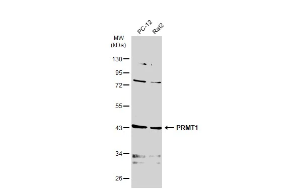 Various whole cell extracts (30 μg) were separated by 10% SDS-PAGE, and the membrane was blotted with PRMT1 antibody [GT779] (GTX630186) diluted at 1:1000. The HRP-conjugated anti-mouse IgG antibody (GTX213111-01) was used to detect the primary antibody.