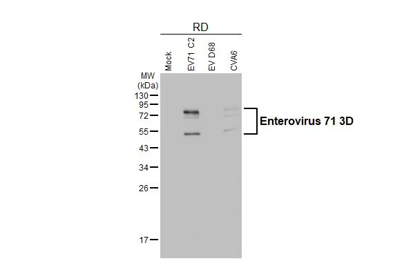 Anti-Enterovirus 71 3D antibody [4] (GTX630193) | GeneTex