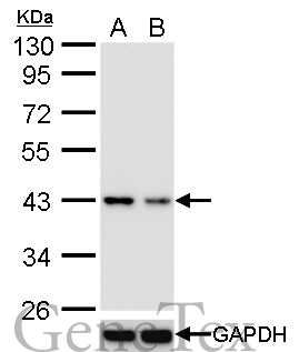 TARDBP antibody [GT733] validation by siRNA knock-down. Upperpanel: TARDBP antibody [GT733] GTX630197 Lower panel: GAPDH antibody (GTX100118) A. 30 μg 293T whole cell lysate/extract B. 30 μg whole cell lysate/extract of TARDBP shRNA-transfected 293T cells 10 % SDS-PAGE TARDBP antibody [GT733] (GTX630197) dilution: 1:1000 GAPDH antibody (GTX100118) dilution: 1:10000
