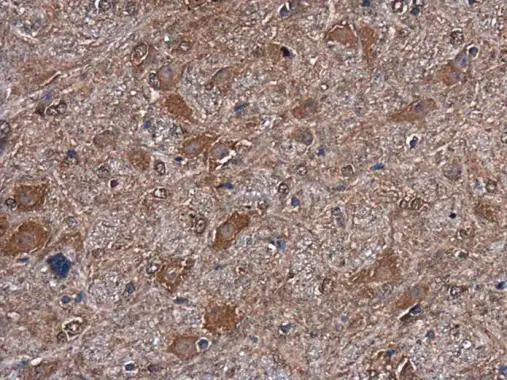 mTOR antibody [GT649] detects mTOR protein at cytoplasm in mouse brain by immunohistochemical analysis. Sample: Paraffin-embedded mouse brain. mTOR antibody [GT649] (GTX630198) diluted at 1:100. 
 Antigen Retrieval: Citrate buffer, pH 6.0, 15 min