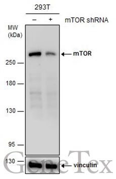 Non-transfected (–) and transfected (+) 293T whole cell extracts (30 μg) were separated by 5% SDS-PAGE, and the membrane was blotted with mTOR antibody [GT6611] (GTX630199) diluted at 1:500.
