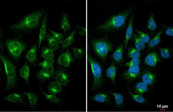 mTOR antibody [GT6611] detects mTOR protein at Golgi apparatus by immunofluorescent analysis. Sample: HeLa cells were fixed in 4% paraformaldehyde at RT for 15 min. Green: mTOR stained by mTOR antibody [GT6611] (GTX630199) diluted at 1:500. Blue: Fluoroshield with DAPI (GTX30920).