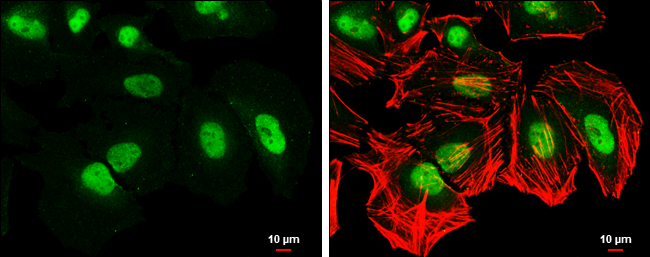 CSE1L antibody [GT5111] detects CSE1L protein at nucleus by immunofluorescent analysis. Sample: HeLa cells were fixed in 4% paraformaldehyde at RT for 15 min. Green: CSE1L stained by CSE1L antibody [GT5111] (GTX630394) diluted at 1:500. Red: phalloidin, a cytoskeleton marker, diluted at 1:100. Scale bar= 10μm.