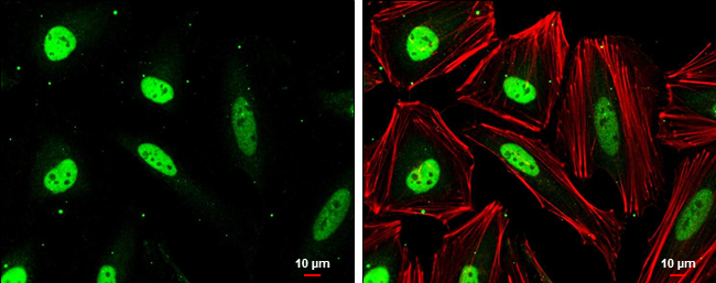 CSE1L antibody [GT729] detects CSE1L protein at nucleus by immunofluorescent analysis. Sample: HeLa cells were fixed in 4% paraformaldehyde at RT for 15 min. Green: CSE1L stained by CSE1L antibody [GT729] (GTX630395) diluted at 1:500. Red: phalloidin, a cytoskeleton marker, diluted at 1:100. Scale bar= 10μm.