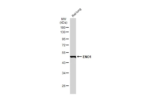 Rat tissue extract (50 μg) was separated by 10% SDS-PAGE, and the membrane was blotted with ENO1 antibody [GT186] (GTX630506) diluted at 1:10000. The HRP-conjugated anti-mouse IgG antibody (GTX213111-01) was used to detect the primary antibody.