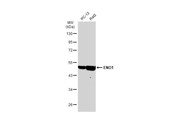 Various whole cell extracts (30 μg) were separated by 10% SDS-PAGE, and the membrane was blotted with ENO1 antibody [GT186] (GTX630506) diluted at 1:10000. The HRP-conjugated anti-mouse IgG antibody (GTX213111-01) was used to detect the primary antibody.