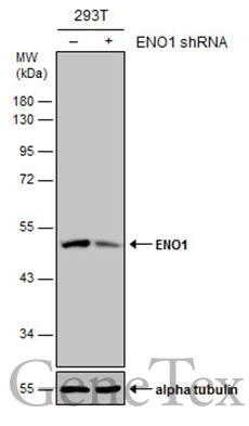 Non-transfected (–) and transfected (+) 293T whole cell extracts (30 μg) were separated by 10% SDS-PAGE, and the membrane was blotted with ENO1 antibody [GT2217] (GTX630507) diluted at 1:15000.