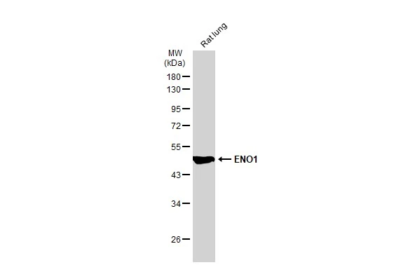 Rat tissue extract (50 μg) was separated by 10% SDS-PAGE, and the membrane was blotted with ENO1 antibody [GT2217] (GTX630507) diluted at 1:10000. The HRP-conjugated anti-mouse IgG antibody (GTX213111-01) was used to detect the primary antibody.