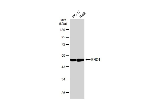 Various whole cell extracts (30 μg) were separated by 10% SDS-PAGE, and the membrane was blotted with ENO1 antibody [GT2217] (GTX630507) diluted at 1:10000. The HRP-conjugated anti-mouse IgG antibody (GTX213111-01) was used to detect the primary antibody.