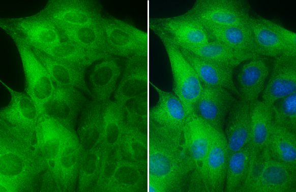MEK1 + MEK2 antibody [GT1721] detects MEK1 + MEK2 protein at cytoplasm by immunofluorescent analysis. Sample: MDCK cells were fixed in 4% paraformaldehyde at RT for 15 min. Green: MEK2 stained by MEK1 + MEK2 antibody [GT1721] (GTX630542) diluted at 1:500. Blue: Hoechst 33342 staining.