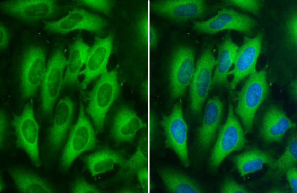 MEK1 + MEK2 antibody [GT1721] detects MEK1 + MEK2 protein at cytoplasm by immunofluorescent analysis. Sample: HeLa cells were fixed in 4% paraformaldehyde at RT for 15 min. Green: MEK1 + MEK2 stained by MEK1 + MEK2 antibody [GT1721] (GTX630542) diluted at 1:500. Blue: Hoechst 33342 staining.