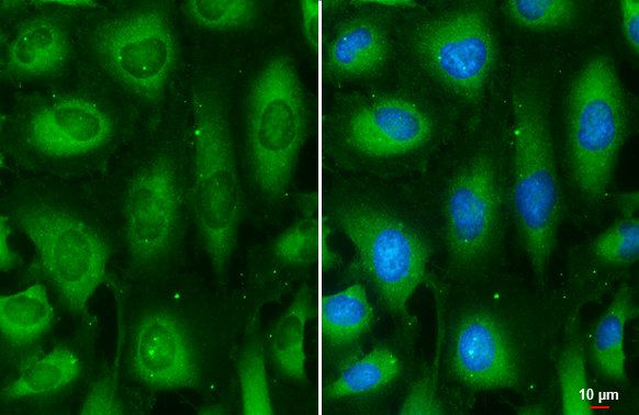 MEK2 antibody [GT3522] detects MEK2 protein at cytoplasm by immunofluorescent analysis. Sample: HeLa cells were fixed in 4% paraformaldehyde at RT for 15 min. Green: MEK2 stained by MEK2 antibody [GT3522] (GTX630543) diluted at 1:500. Blue: Hoechst 33342 staining. Scale bar= 10 μm.