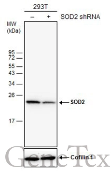 Non-transfected (–) and transfected (+) 293T whole cell extracts (30 μg) were separated by 15% SDS-PAGE, and the membrane was blotted with SOD2 antibody [GT582] (GTX630558) diluted at 1:10000.