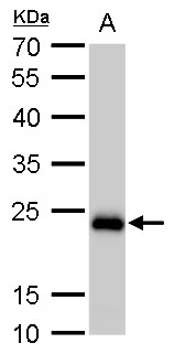 SOD2 antibody [GT582] detects SOD2 protein by western blot analysis. A. 50 μg mouse brain lysate/extract 12 % SDS-PAGE SOD2 antibody [GT582] (GTX630558) dilution: 1:5000