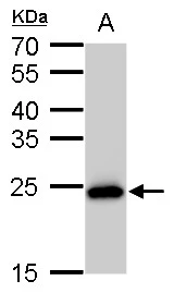 SOD2 antibody [GT582] detects SOD2 protein by western blot analysis. A. 50 μg rat brain lysate/extract 12 % SDS-PAGE SOD2 antibody [GT582] (GTX630558) dilution: 1:5000