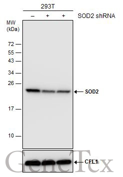 Non-transfected (–) and transfected (+) 293T whole cell extracts (30 μg) were separated by 15% SDS-PAGE, and the membrane was blotted with SOD2 antibody [GT1433] (GTX630559) diluted at 1:2000.