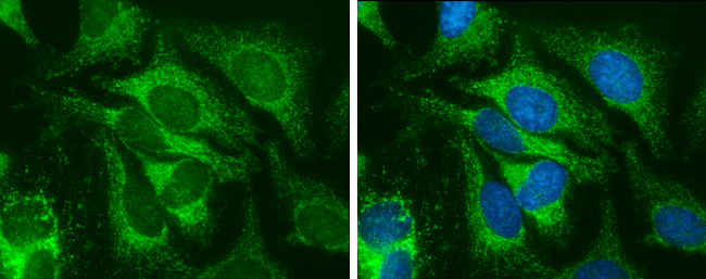 SOD2 antibody [GT1433] detects SOD2 protein at mitochondria by immunofluorescent analysis. Sample: HeLa cells were fixed in ice-cold MeOH for 5 min. Green: SOD2 stained by SOD2 antibody [GT1433] (GTX630559) diluted at 1:100. Blue: Hoechst 33342 staining.