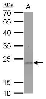 SOD2 antibody [GT1433] detects SOD2 protein by western blot analysis. A. 50 μg mouse brain lysate/extract 12 % SDS-PAGE SOD2 antibody [GT1433] (GTX630559) dilution: 1:1000
