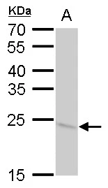 SOD2 antibody [GT1433] detects SOD2 protein by western blot analysis. A. 50 μg rat brain lysate/extract 12 % SDS-PAGE SOD2 antibody [GT1433] (GTX630559) dilution: 1:1000