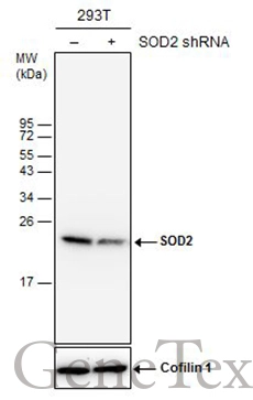 Non-transfected (–) and transfected (+) 293T whole cell extracts (30 μg) were separated by 15% SDS-PAGE, and the membrane was blotted with SOD2 antibody [GT17112] (GTX630560) diluted at 1:5000.